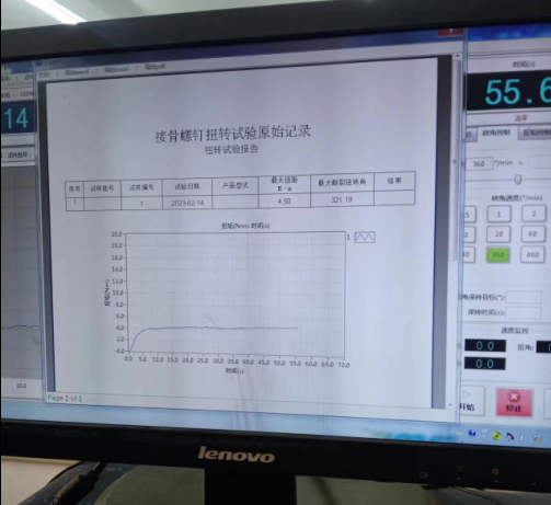 根管扭转9.png